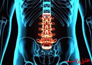 تحلیل ایران -ضایعه نخاعی به متابولیسم بدن آسیب می رساند