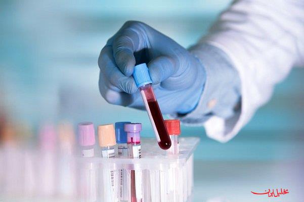  تحلیل ایران -پیش‌بینی سرطان در مراحل اولیه با آزمایش خون