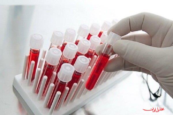  تحلیل ایران -ظرفیت ۴۵۰ هزار لیتری پالایش پلاسما با راه‌اندازی پروژه‌های جدید