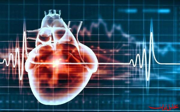  تحلیل ایران -پرتودرمانی می‌تواند اختلال ضربان قلب را درمان کند