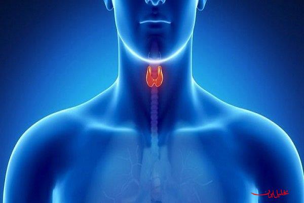  تحلیل ایران -مراقب خرابی «پدال گاز» بدن باشید