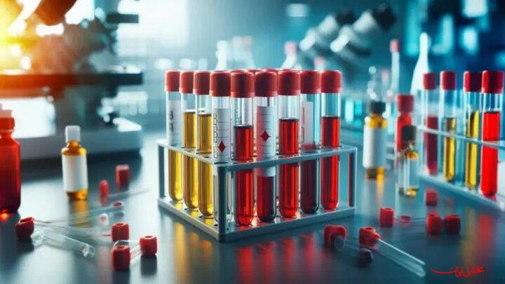  تحلیل ایران -عرضه محصولات جدید شرکت پالایش و پژوهش خون به زودی در کشور