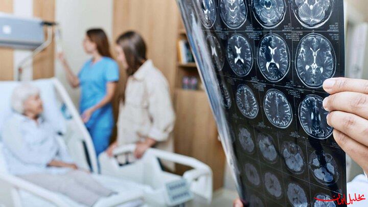  تحلیل ایران -گجت پوشیدنی صدای بیماران دچار سکته را به آنها برمی‌گرداند