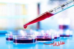  تحلیل ایران -آزمایش خون می‌تواند بیماری کرون را پیش‌بینی کند