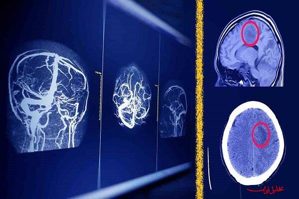  تحلیل ایران -پیش بینی آینده رادیولوژیست‌ها باوجود هوش مصنوعی